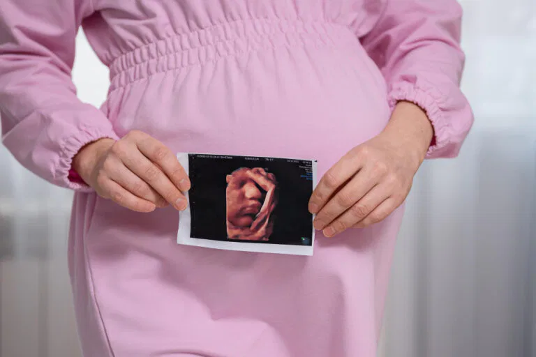 Can You Get Pregnant After Uterine Artery Embolization?