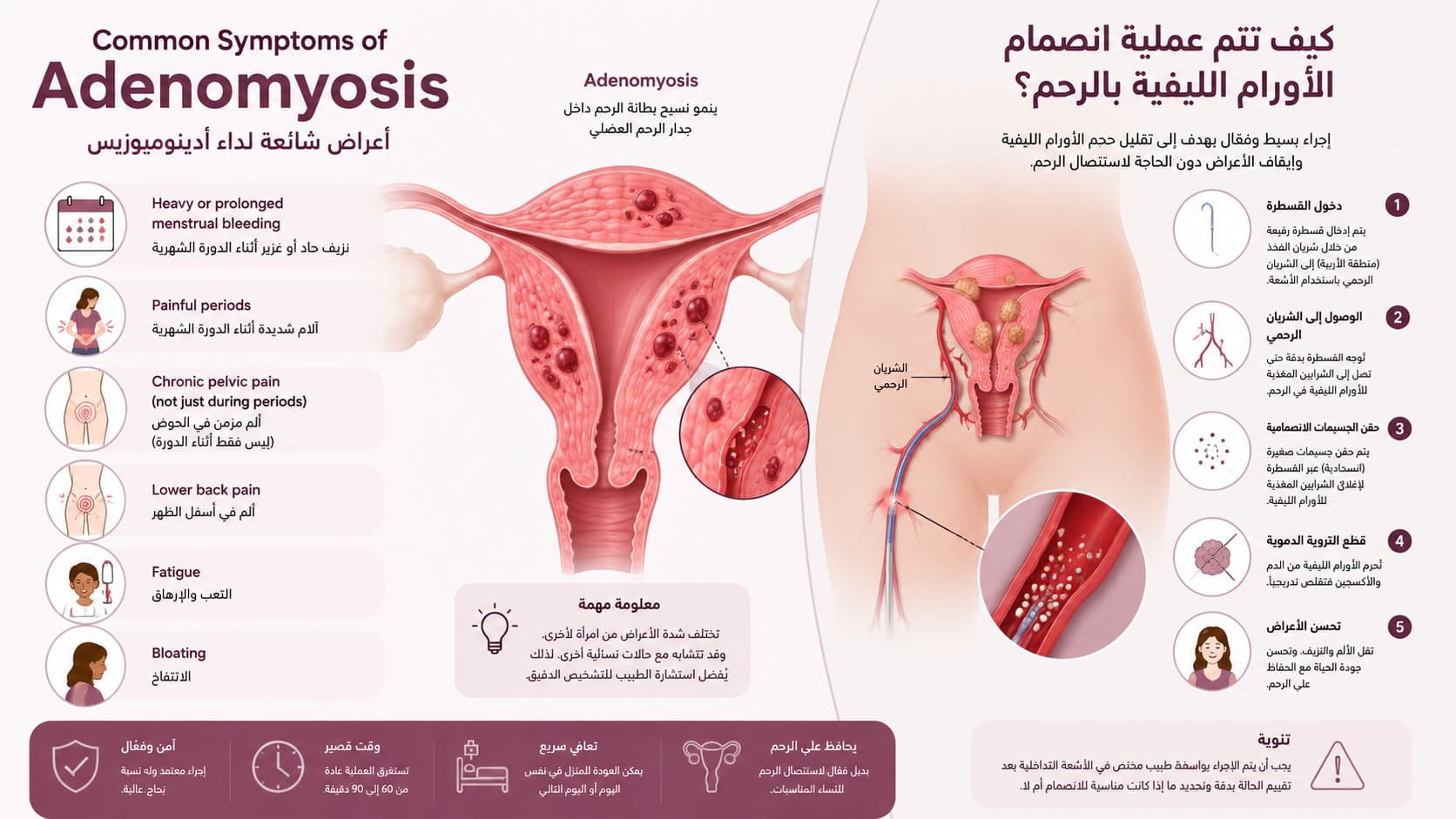  كيف تتم عملية انصمام الأورام الليفية بالرحم؟