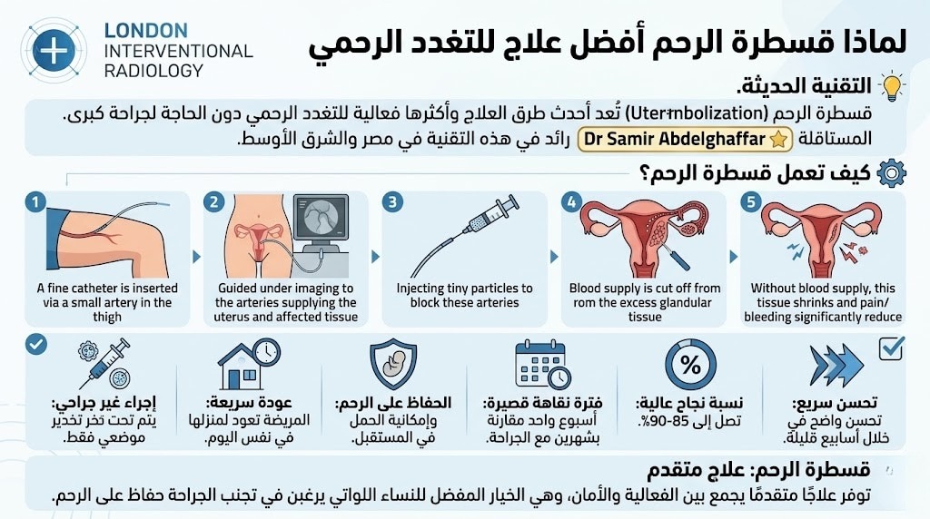 لماذا قسطرة الرحم أفضل علاج للتغدد الرحمي